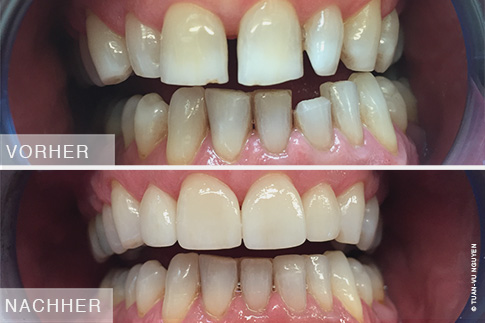 Zahnarzt-Nguyen-Zahnaesthetik